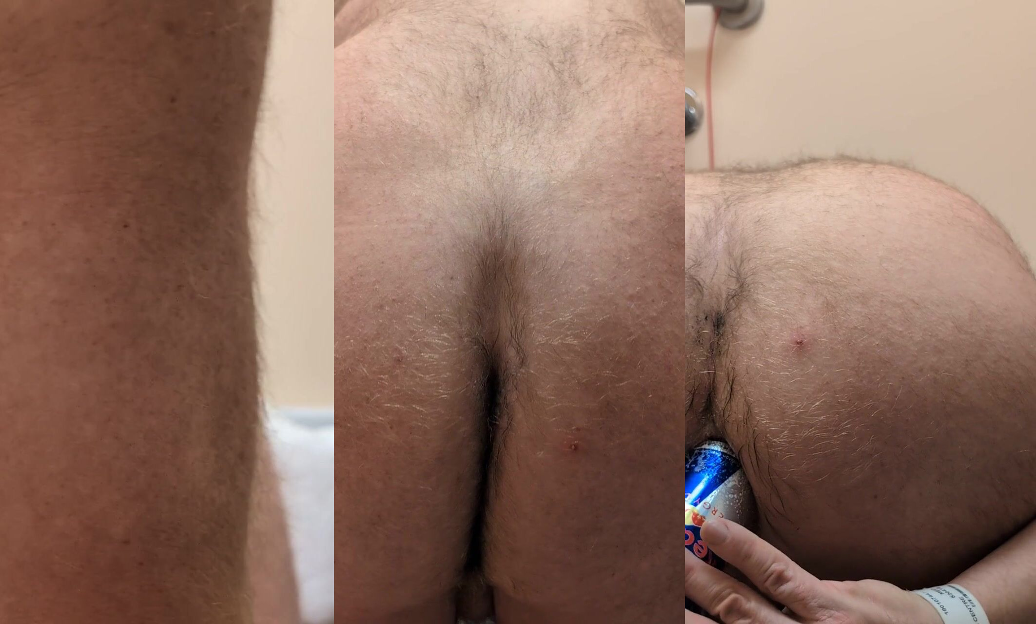 A.P.+A.S. in the Hospital ????-trying different position