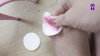 Full feet care for Mary Rider