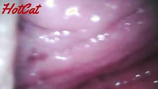 Intriguing Insights: Exploring the World of Endoscopic Observations