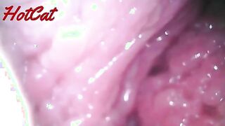 Intriguing Insights: Exploring the World of Endoscopic Observations