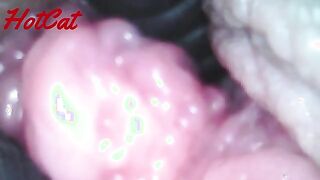 Intriguing Insights: Exploring the World of Endoscopic Observations