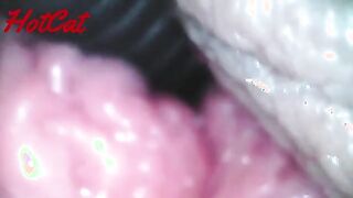 Intriguing Insights: Exploring the World of Endoscopic Observations