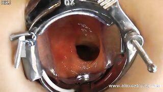 Incredible deep anal view with XO speculum and light in Hotkinkyjo ass